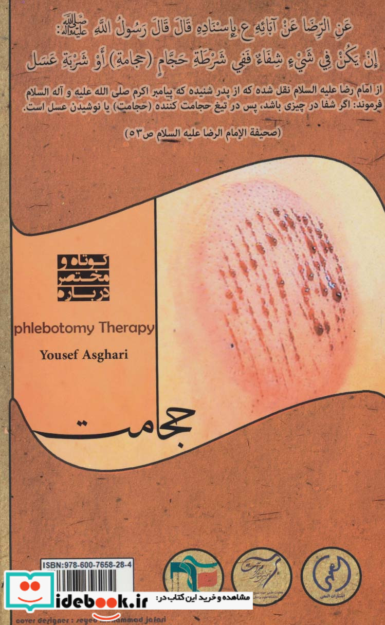 کوتاه و مختصر درباره حجامت