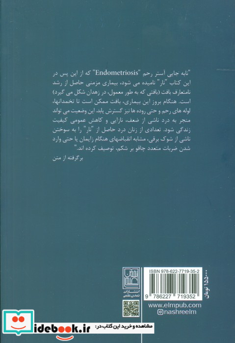 نابجایی آستر رحم زهدان شمیز،رقعی،تمدن علمی
