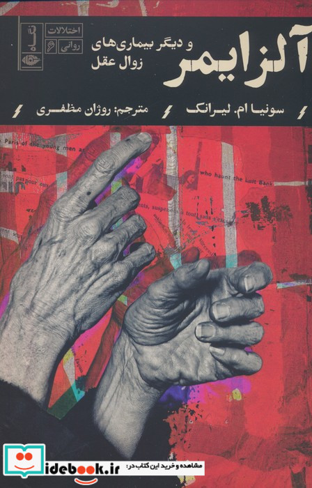 آلزایمر شمیز،رقعی،نگاه