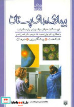 بیماری های پستان