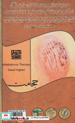 کوتاه و مختصر درباره حجامت
