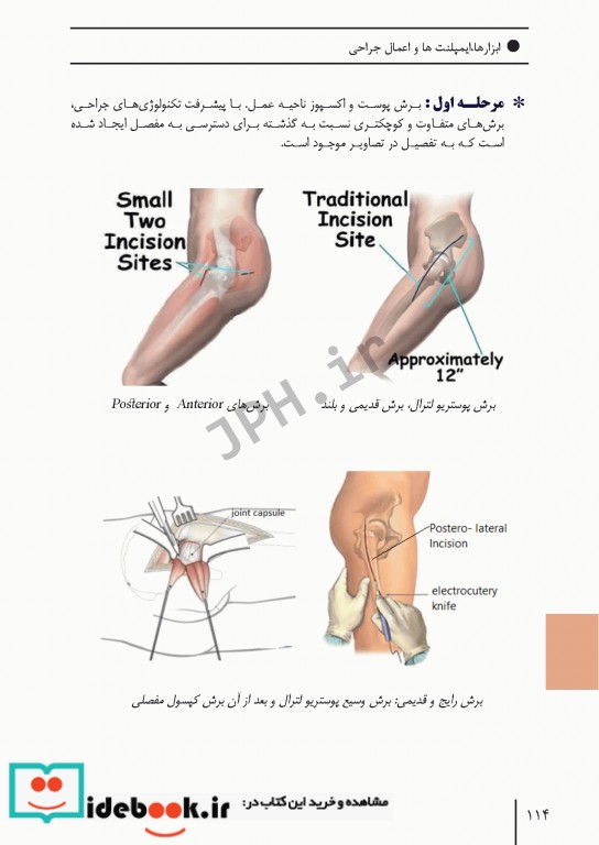 ابزارهای جراحی ایمپلنت های تخصصی و اعمال جراحی شایع ارتوپدی