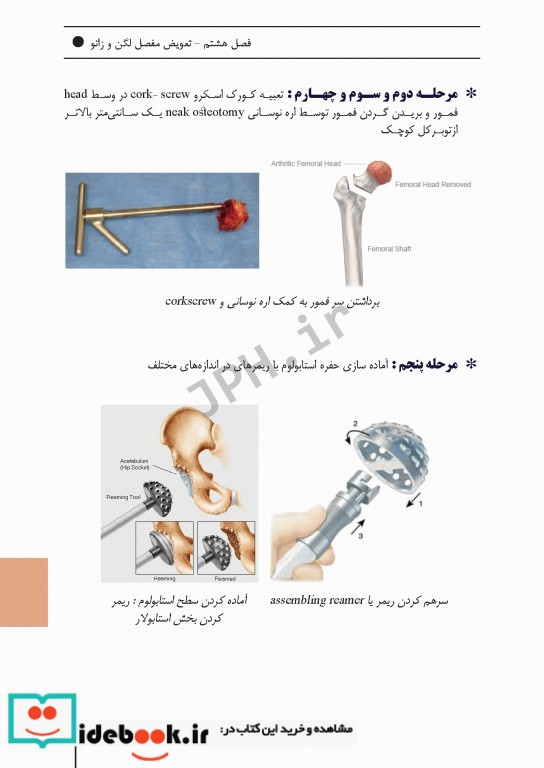 ابزارهای جراحی ایمپلنت های تخصصی و اعمال جراحی شایع ارتوپدی