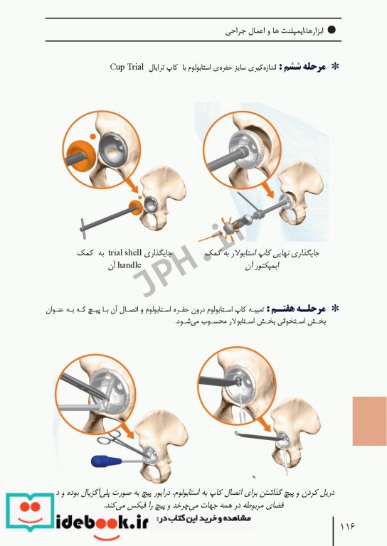 ابزارهای جراحی ایمپلنت های تخصصی و اعمال جراحی شایع ارتوپدی