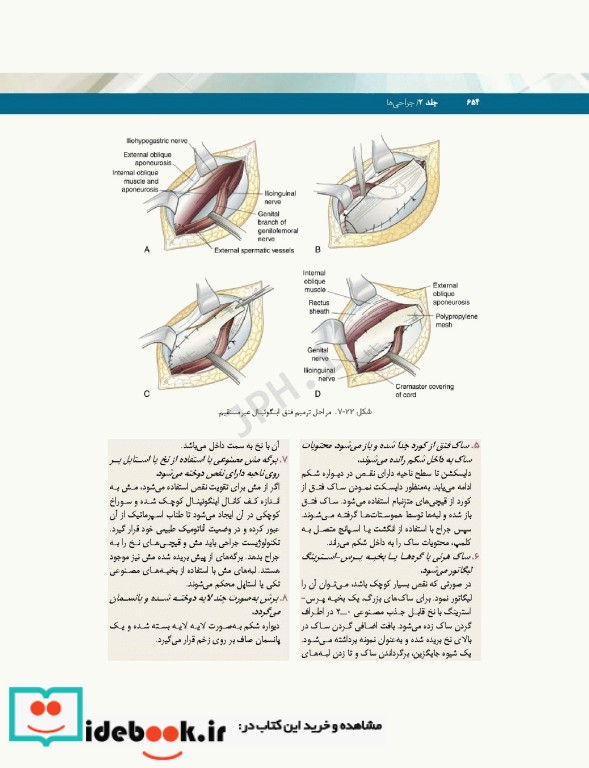 تکنولوژی جراحی فولر2022 جلد2 جراحی ها