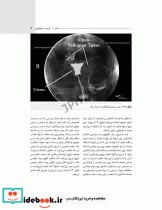 آشنایی با کلیات تصاویر رادیولوژی رایج در اتاق عمل