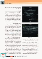 آناتومی سطحی و اولتراسوند گری