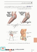 ابزارهای جراحی ایمپلنت های تخصصی و اعمال جراحی شایع ارتوپدی