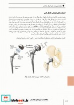 ابزارهای جراحی ایمپلنت های تخصصی و اعمال جراحی شایع ارتوپدی