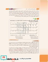 مرور آزمون ERS ارتقا و بورد داخلی قلب