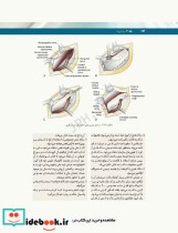 تکنولوژی جراحی فولر2022 جلد2 جراحی ها
