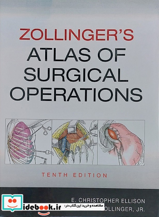 Zollinger's Atlas of Surgical Operations 2022 10 Edition