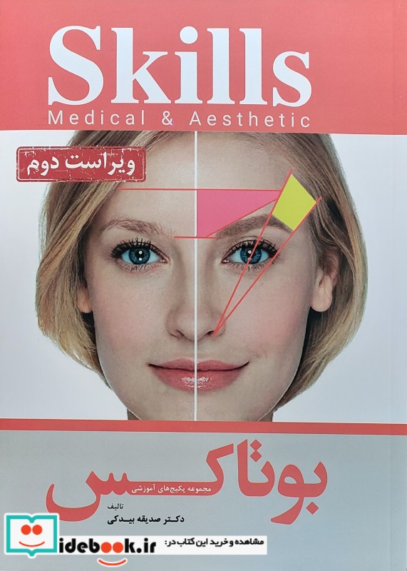 بوتاکس آرتین طب