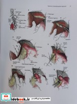 Zollinger's Atlas of Surgical Operations 2022 10 Edition