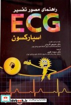 راهنمای مصور تفسیر ECG اسپارکسون