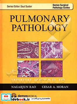 Pulmonary pathology