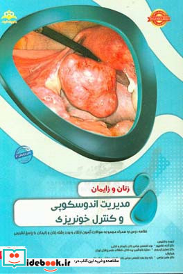 زنان و زایمان مدیریت اندوسکوپی و کنترل خونریزی خلاصه درس به همراه مجموعه سوالات آزمون Te Linde's 2015