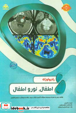 رادیولوژی اطفال نورواطفال مجموعه سوالات آزمون ارتقاء و بورد رادیولوژی با پاسخ تشریحی Brant 2012 کتاب آمادگی آزمون ارتقاء و بورد 97