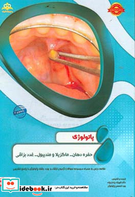 پاتولوژی حفره دهان - ماگزیلا و مندیبول - غدد بزاقی خلاصه درس به همراه مجموعه سوالات آزمون ارتقاء و بورد پاتولوژی با پاسخ تشریحی