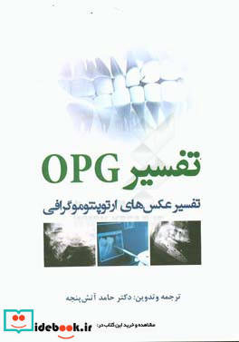 تفسیر OPG تفسیر عکس های ارتوپنتوموگرافی