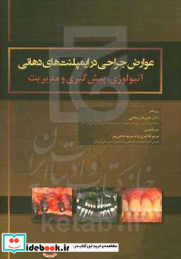 عوارض جراحی در ایمپلنت های دهانی اتیولوژی پیش گیری و مدیریت