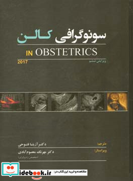 سونوگرافی کالن In obstetrics 2017