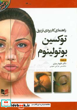 راهنمای کاربردی تزریق توکسین بوتولینوم