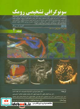 سونوگرافی تشخیصی رومک