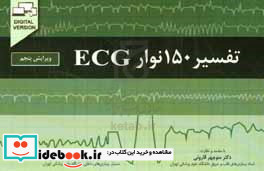 تفسیر150نوارECG ویرایش پنجم