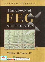 Handbook of EEG interpretation