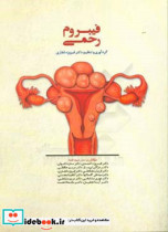 فیبروم رحمی = Uterine fibroid