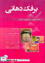 برفک دهانی علائم عوامل پیشگیری درمان قابل استفاده برای پزشکان دندانپزشکان دانشجویان مربوط و نیز علاقمندان