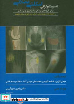 تفسیر رادیوگرافی اسکلتی عضلانی برای گروه های پزشکی رادیولوژی و پرستاری ...