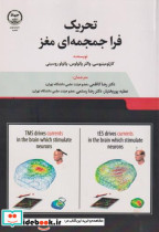 تحریک فراجمجمه ای مغز