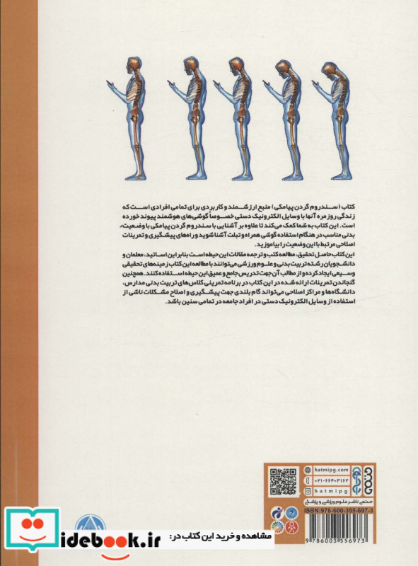 سندروم گردن پیامکی