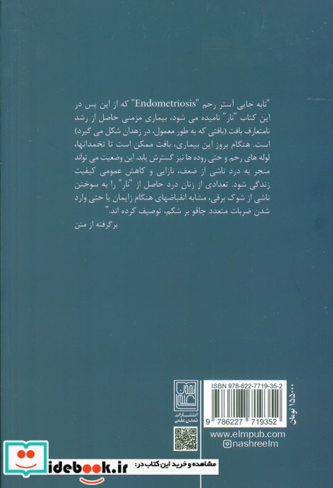 نابجایی آستر رحم