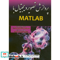 پردازش تصویر دیجیتال با MATLAB