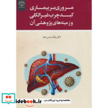 مروری بر بیماری کبد چرب غیرالکلی و زمینه های پژوهشی آن