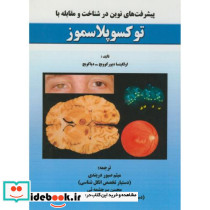 پیشرفت های نوین در شناخت و مقابله با توکسوپلاسموز
