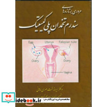مروری برتازه های سندرم تخمدان پلی کیستیک