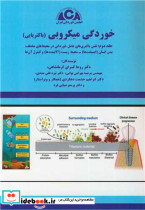 خوردگی میکروبی