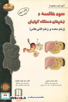 سوء هاضمه و زخم های گوارشی