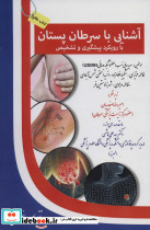آشنایی با سرطان پستان