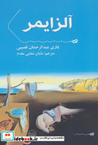 آلزایمر نشر عینک