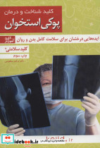 پوکی استخوان نشر کلید آموش