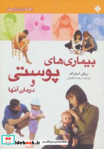 بیماری های پوستی و درمان آنها