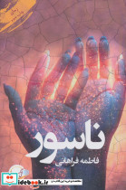 ناسور نشر آئی سا